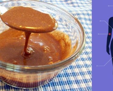 Cinnamon And Honey Fights Off Colds, Flu, Acne, Weight Loss And More