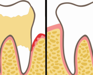 Dentists Explain 7 Habits That Can Ruin Your Teeth and Gums (And How to Fix It)