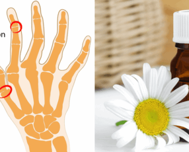 The Essential Oil That Fights Anxiety, Relieves Arthritis Pain & Helps You Sleep