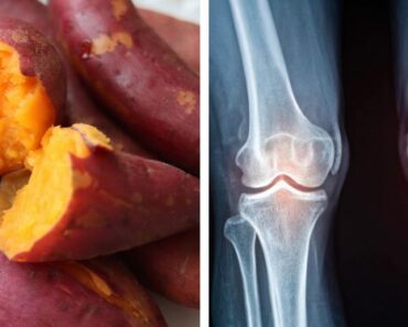 20 Natural Foods That Reduce Inflammation and Protect Joints
