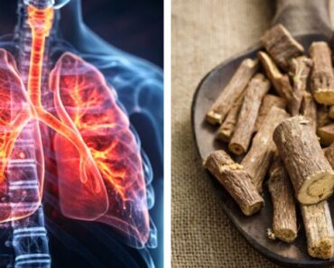 9 Natural Remedies to Detox Your Lungs After Years of Pollution or Smoking